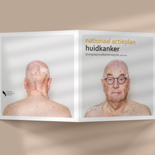 Nationaal Actieplan Huidkanker - Nederlandse Vereniging van Huidtherapeuten